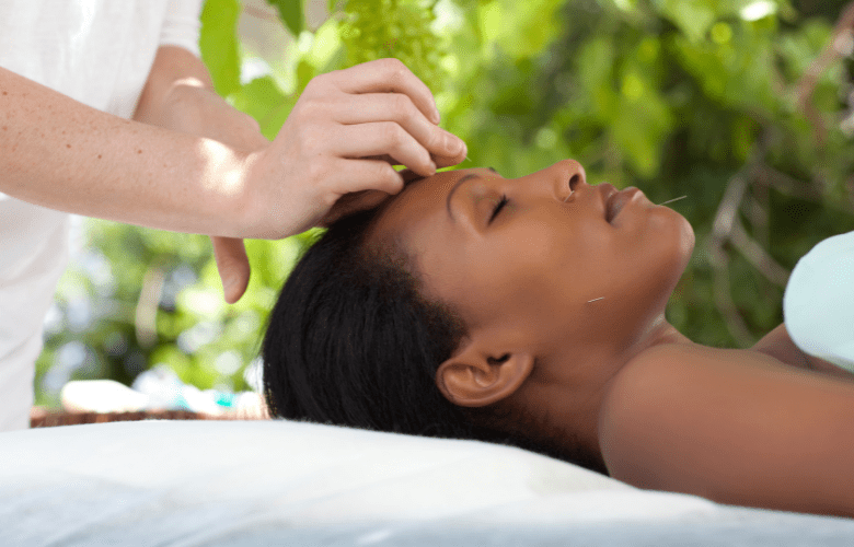 The Benefits of Cosmetic Acupuncture