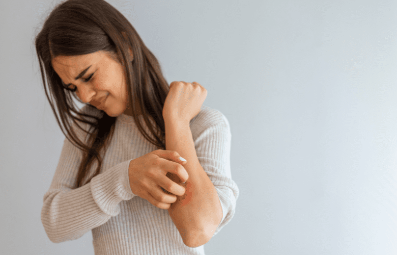 7 Proven Methods to Treat Psoriasis with TCM & Functional Medicine